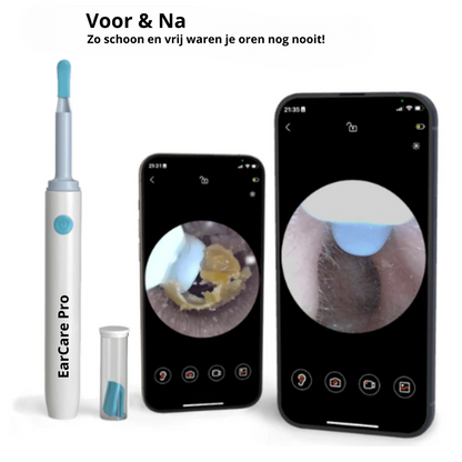 EarCare Pro I Oor Reiniger