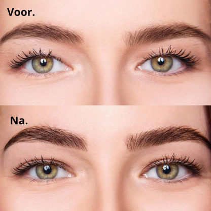 GlamLids I Directe Ooglidcorrectie Zonder Chirurgie