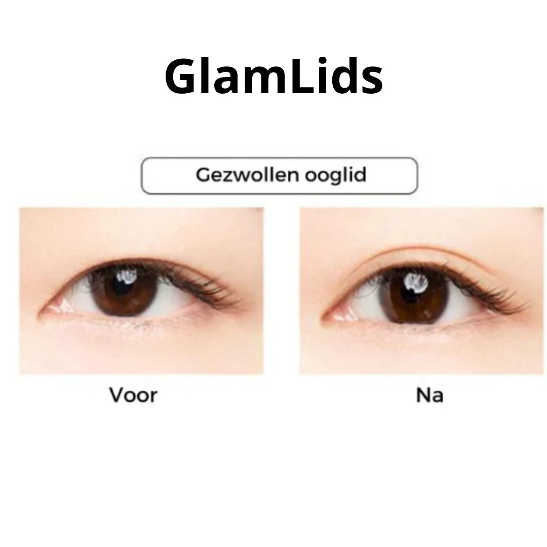 GlamLids I Directe Ooglidcorrectie Zonder Chirurgie