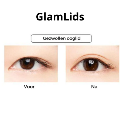 GlamLids I Directe Ooglidcorrectie Zonder Chirurgie
