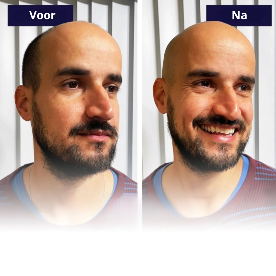 HeadGlide | Hoofd Scheerapparaat