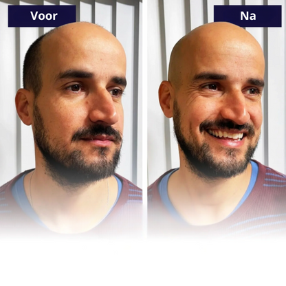 HeadGlide | Hoofd Scheerapparaat