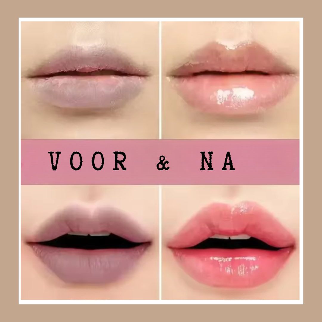 Glosy Lips – vermindert verkleuring en geeft je lippen een frisse, natuurlijke glans.