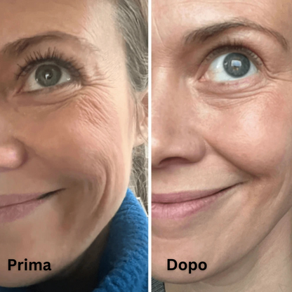 Lifting Glow I Huidverjonging